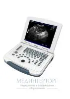 Ветеринарный УЗИ сканер начального класса MU-10 Vet